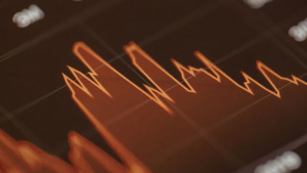 Gráfico de empresa em queda na bolsa representando movimentos de volatilidade